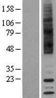TA3 (TAAR9) Human Over-expression Lysates NM_175057