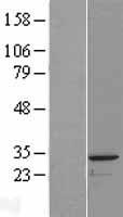 PACRG Human Over-expression Lysates NM_001080378