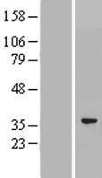 PACRG Human Over-expression Lysates NM_152410