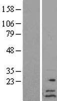 C6orf57 (SDHAF4) Human Over-expression Lysates NM_145267