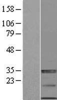 ULBP4 (RAET1E) Human Over-expression Lysates NM_139165
