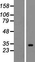 HUS1B Human Over-expression Lysates NM_148959
