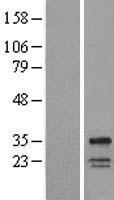 WBS28 (WBSCR28) Human Over-expression Lysates NM_182504