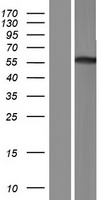 TRIM50 Human Over-expression Lysates NM_178125