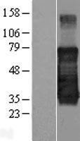 ls135932 tmem139 human over expression lysates nm 153345 wb testing 1