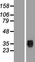 SSMEM1 Human Over-expression Lysates NM_145268