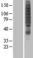 SVOPL Human Over-expression Lysates NM_174959