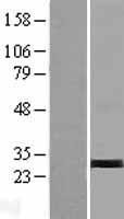 TRY1 (PRSS58) Human Over-expression Lysates NM_001001317