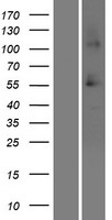 ls136853 srcrb4d ssc4d human over expression lysates nm 080744 wb testing 1
