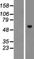 ls137209 znf572 human over expression lysates nm 152412 wb testing 1