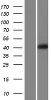 VPS37A Human Over-expression Lysates NM_001145152