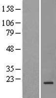 NDUFAF6 Human Over-expression Lysates NM_152416