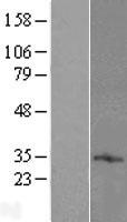ls137835 tmem71 human over expression lysates nm 144649 wb testing 1