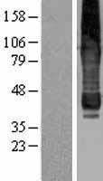 ls137964 gpat4 human over expression lysates nm 178819 wb testing 1