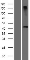 DCAF4L2 Human Over-expression Lysates NM_152418