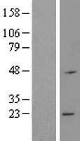 RNF183 Human Over-expression Lysates NM_145051
