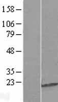 C9orf85 Human Over-expression Lysates NM_182505