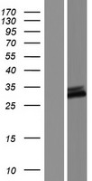 C9orf135 Human Over-expression Lysates NM_001010940