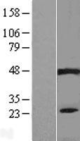 PIP5KL1 Human Over-expression Lysates NM_173492