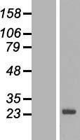 SPANXN3 Human Over-expression Lysates NM_001009609