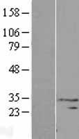 ls139212 dnaaf6 human over expression lysates nm 173494 wb testing 2