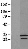 Apolipoprotein O like (APOOL) Human Over-expression Lysates NM_198450