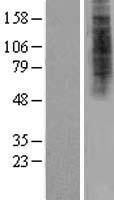 ls139324 hdx human over expression lysates nm 144657 wb testing 1