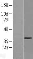 UPRT Human Over-expression Lysates NM_145052