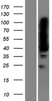 ls139604 mageb16 human over expression lysates nm 001099921 wb testing 1