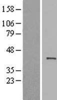 ls139741 actrt1 human over expression lysates nm 138289 wb testing 1