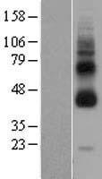 GPR119 Human Over-expression Lysates NM_178471