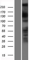 DOCK11 Human Over-expression Lysates NM_144658