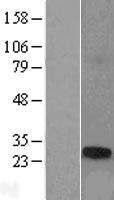ls140290 tcp10l human over expression lysates nm 144659 wb testing 1