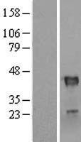 RNF113B Human Over-expression Lysates NM_178861