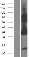 ls140462 asb9 human over expression lysates nm 001168530 wb testing 2