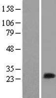 ls140465 mlc1sa myl6b human over expression lysates nm 002475 wb testing 1