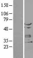 CHODL Human Over-expression Lysates NM_024944