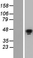 GATA5 Human Over-expression Lysates NM_080473