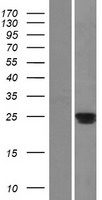 C20orf70 (BPIFA2) Human Over-expression Lysates NM_080574
