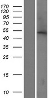 ls140701 abhd16b human over expression lysates nm 080622 wb testing 1