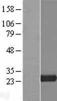 C20orf118 (TLDC2) Human Over-expression Lysates NM_080628