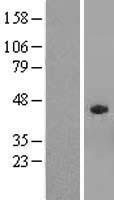 SPAG4L (SUN5) Human Over-expression Lysates NM_080675