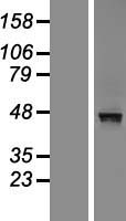 MACROD2 Human Over-expression Lysates NM_080676