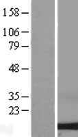 Dynein (DYNLL2) Human Over-expression Lysates NM_080677