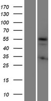 KRT72 Human Over-expression Lysates NM_080747