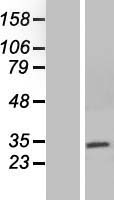 NEURL2 Human Over-expression Lysates NM_080749