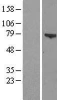 ZSWIM3 Human Over-expression Lysates NM_080752