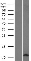 ls140850 defb127 human over expression lysates nm 139074 wb testing 1