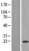 C20orf79 (SCP2D1) Human Over-expression Lysates NM_178483
