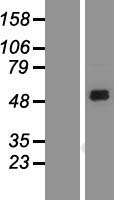 SIRP alpha (SIRPA) Human Over-expression Lysates NM_001040023